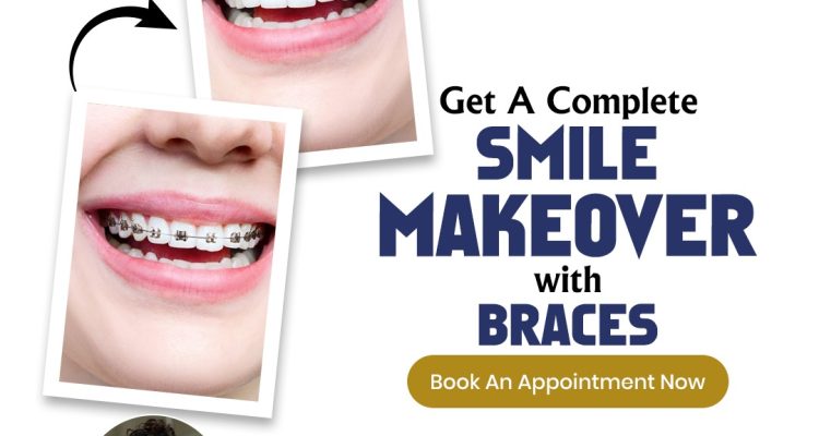 Best Dentist in Jaipur for your smile