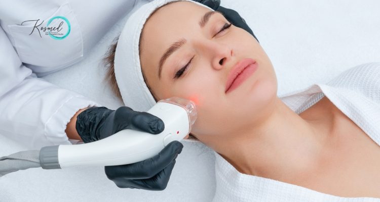 Laser Skin Treatments