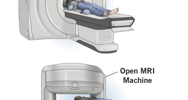 Mri Parts