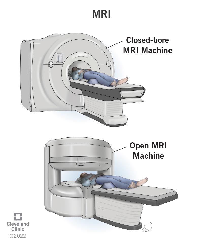 Mri Parts