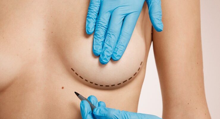 woman-marked-out-cosmetic-surgery_273609-14510